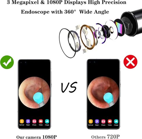 أداة إزالة شمع الأذن من BEBIRD R1، منظف الأذن اللاسلكي بدقة 1080 بكسل HD مع 6 مصابيح LED متوافقة مع هواتف iPhone iPad الذكية والأجهزة اللوحية للأطفال البالغين والحيوانات الأليفة (أبيض) in Kuwait