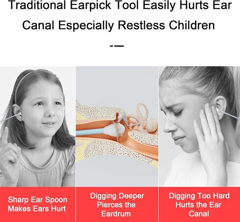 أداة إزالة شمع الأذن من BEBIRD R1، منظف الأذن اللاسلكي بدقة 1080 بكسل HD مع 6 مصابيح LED متوافقة مع هواتف iPhone iPad الذكية والأجهزة اللوحية للأطفال البالغين والحيوانات الأليفة (أبيض) in Kuwait