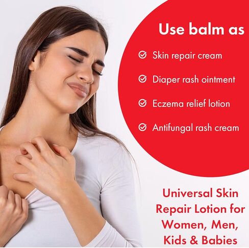 كريم ناترولو لإصلاح البشرة | مرهم طبيعي متعدد الأغراض للأكزيما وتخفيف الحكة والعضات والحروق وطفح الحفاضات والقوباء الحلقية والعناية بالجروح | مرهم إصلاح الإنقاذ للعناية بالبشرة in Kuwait