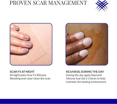 صفائح سيليكون ذاتية اللصق، 3.8 سم × 7.6 سم، قطعة واحدة in Kuwait