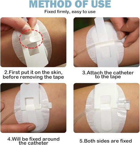 20 قطعة من جهاز تثبيت القسطرة، حوامل انبوب التغذية، رقع غسيل الكلى، حامل شريط الساق، حامل انبوب القسطرة، ملصق ثقوب التعرق، ضمادات لاصقة لتثبيت فتحة التصريف in Kuwait