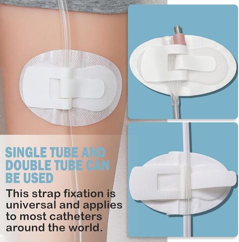 20 قطعة من جهاز تثبيت القسطرة، حوامل انبوب التغذية، رقع غسيل الكلى، حامل شريط الساق، حامل انبوب القسطرة، ملصق ثقوب التعرق، ضمادات لاصقة لتثبيت فتحة التصريف in Kuwait