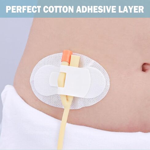 20 قطعة من جهاز تثبيت القسطرة، حوامل انبوب التغذية، رقع غسيل الكلى، حامل شريط الساق، حامل انبوب القسطرة، ملصق ثقوب التعرق، ضمادات لاصقة لتثبيت فتحة التصريف in Kuwait