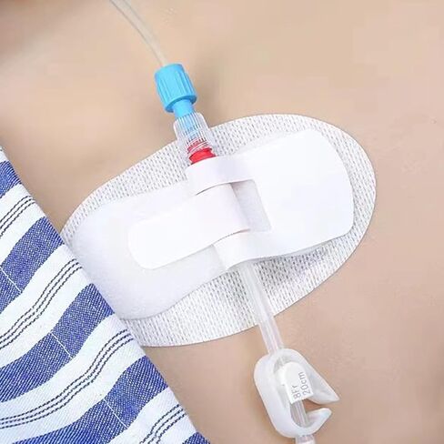 20 قطعة من جهاز تثبيت القسطرة، حوامل انبوب التغذية، رقع غسيل الكلى، حامل شريط الساق، حامل انبوب القسطرة، ملصق ثقوب التعرق، ضمادات لاصقة لتثبيت فتحة التصريف in Kuwait