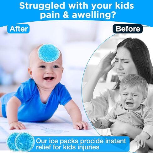 TrelaCo 60 Pack Small Round Gel Ice Packs Reusable Cold Packs Boo Boo Ice Packs for Kids, Cold Hot Compress for Pain Relief, Injuries, Wisdom Teeth, Breastfeeding, Tired Eyes, Face, Neck, Headaches in Saudi Arabia