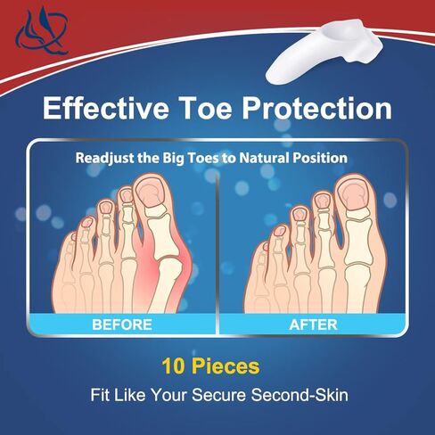 Bunion Corrector for Women Men, Toe Separators for Women, Toe Spacers for Bunion Relief (2 Loops), Bunion Pads with Gel Shield, Bunion Cushion Protector for Hammer Toes, Friction, Calluses, 10 Packs in Kuwait
