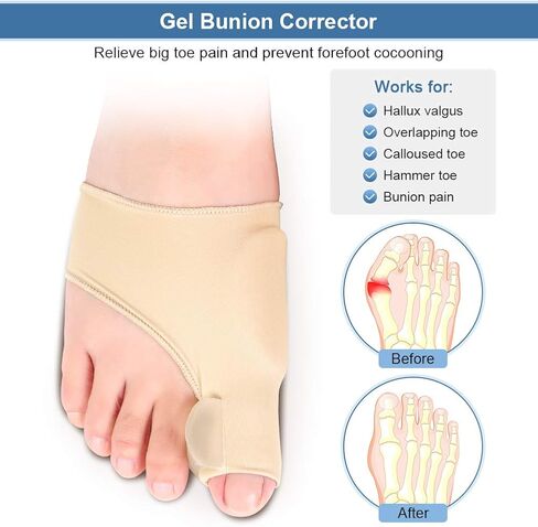 Bunion Corrector and Bunion Relief, Bunion Corrector for Women Bunion Protector Sleeve Gel Bunion Guard for Hallux Valgus, 1 Pair Toe Separator Straightener Spacers for Men and Women in Saudi Arabia