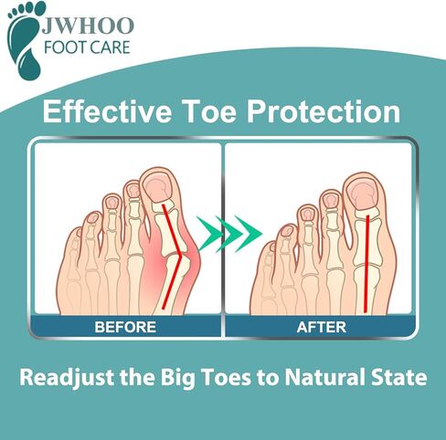 JWHOO Bunion Corrector for Women, Toe Spacers(14 Pack), Gel Toe Separator, Hammer Toe Straightener with 2 Loops, Bunion Relief, Big Toe Alignmen, Prevent Overlapping Toes, Corns and Blisters in Kuwait