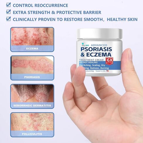 كريم الأكزيما الصدفية من بيو إم دي، كريم الأكزيما للبالغين، تكرار التحكم في القوة الإضافية، تخفيف أعراض المقاومة، فعال لعلاج التهاب الجلد الدهني والصدفية والأكزيما in Kuwait