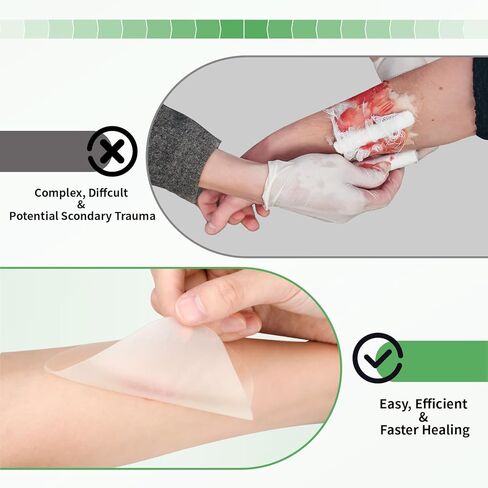 ضمادات غرواني مائي من RHINO RESCUE، 10 عبوات رفيعة جدًا مقاس 4 × 4 بوصات كبيرة من ضمادات الغروانية المائية للإفرازات الخفيفة وحب الشباب وقرحة الفراش والحرق والبثور in Kuwait