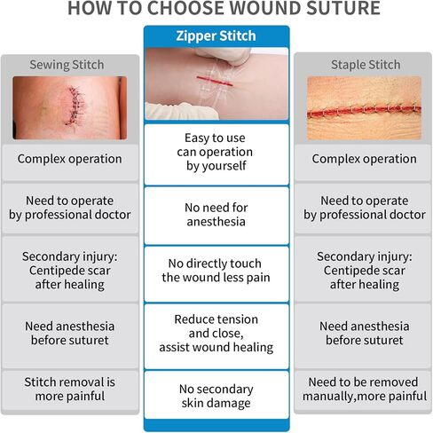 Emergency Wound Closure Zippers, 4 Pcs Zip Stitch Sutures Butterfly Bandaids, Repair Wounds Without Stitches, Great for Outdoor Activities, Quick Clot -Emergency Wound Closures Device in Kuwait