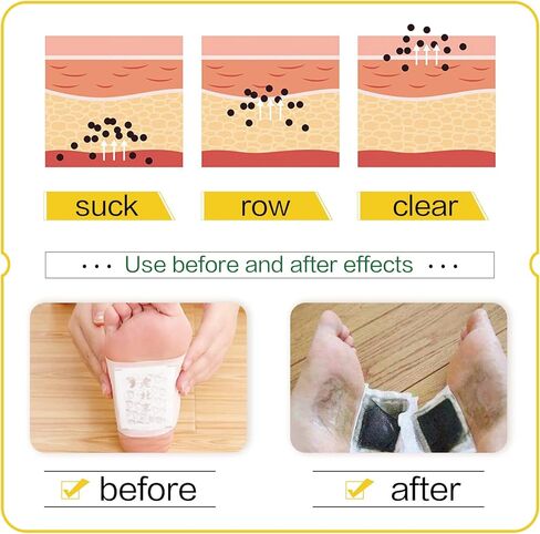 50 وسادة قدم بالزنجبيل لتخفيف التوتر، طبي طبيعي للتنظيف العميق للعناية بالقدم وتحسين تورم القدمين وتحسين النوم in Kuwait