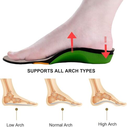 Everhealth Plantar Fasciitis Insoles Orthotic Arch Support Shoe Inserts Insoles for Women Men, Shock Absorption Cushioning Insoles Supportive for Flat Feet, High Arch, Foot Heel Pain, Metatarsalgia in Kuwait