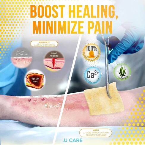 ضمادة ألجينات الكالسيوم والعسل من JJ CARE [عبوة من 10]، وسادات للعناية بالجروح بعسل مانوكا 2 × 2، رقع عسل طبية من الدرجة الطبية، تضميد جروح خالية من اللاتكس، معقمة ومعبأة بشكل فردي in Saudi Arabia