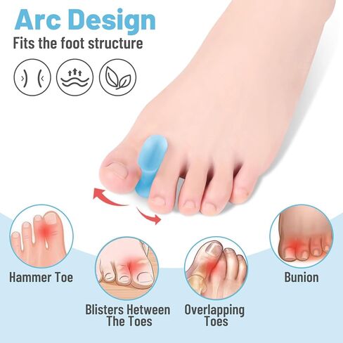 18 حزمة من فواصل أصابع القدم الجل من OYANIMO، مصحح الورم، أدوات فرد أصابع القدم من السيليكون الناعم لمحاذاة أصابع القدم المتداخلة in Kuwait