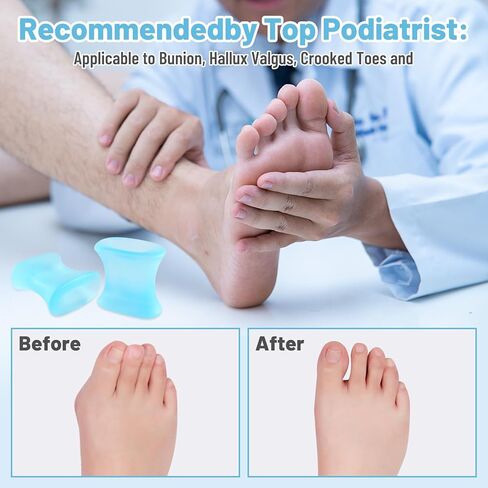 18 حزمة من فواصل أصابع القدم الجل من OYANIMO، مصحح الورم، أدوات فرد أصابع القدم من السيليكون الناعم لمحاذاة أصابع القدم المتداخلة in Kuwait