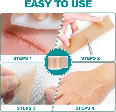 أوراق ندبات طويلة للغاية من السيليكون (لفة 1.6 بوصة × 200 بوصة - 5 أمتار)، شريط ندبات من السيليكون، أوراق إزالة الندبات قابلة لإعادة الاستخدام، شرائط احترافية لإزالة الندبات للندبات الجراحية، الجدرة، القسم القيصري، الحروق، حب الشباب، إلخ in Kuwait