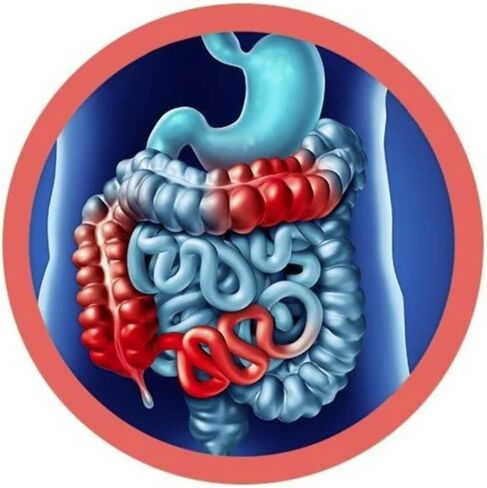 GIANTmicrobes Crohn’s & Colitis - Anatomical Organ Toy, Get Well Gift for Intestinal and GI Health, Unique Gift for Family, Friends, Students, Educators, Gastroenterologists and Other Doctors in Saudi Arabia