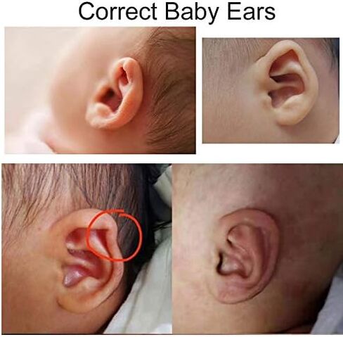 Lightmate Baby Soft Breathable Silicone Ear Correctors Tape,Baby Auricle Valgus Correction Patch for Child Infant Baby Ear Correction Personal Health Care Ear Care Tools in Saudi Arabia