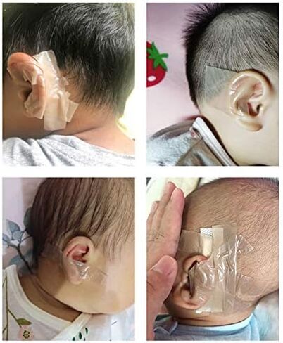 Lightmate Baby Soft Breathable Silicone Ear Correctors Tape,Baby Auricle Valgus Correction Patch for Child Infant Baby Ear Correction Personal Health Care Ear Care Tools in Saudi Arabia
