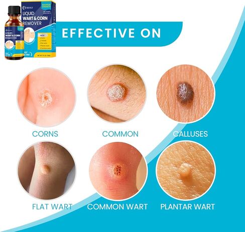 Grehge trength Liquid Wart & Corn Gel مع تركيبة حصرية لإزالة سريعة المفعول للثآليل الأخمصية والشائعة والمسطحة in Kuwait