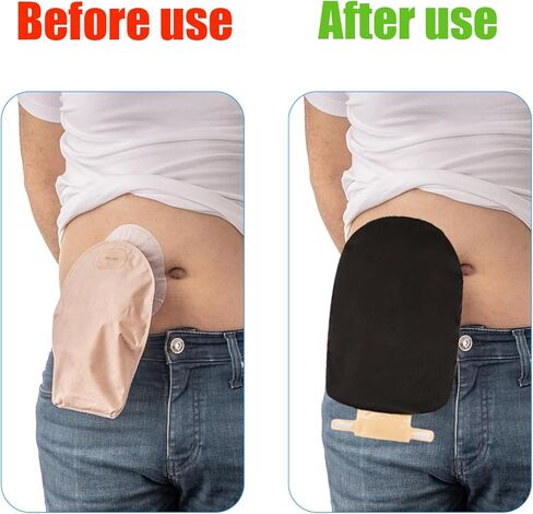 أغطية أكياس الفغرة من FSUHHIAD - أغطية أكياس فغرة القولون المقاومة للماء مع فتحة قابلة للتعديل in Kuwait