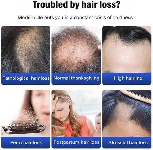 2PCS Horse Oil Shampoo, Horse Oil Nourishing Shampoo-No.1 Japan, Pure Horse Oil Argan Shampoo and Conditioner in Kuwait