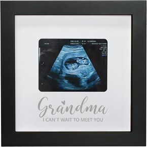 كتاب ضيوف بإطار توقيع Sonogram، إطار تذكار للصور بالموجات فوق الصوتية، بدائل كتاب ضيوف استحمام الطفل، هدية للأمهات الحوامل، أبيض in Kuwait