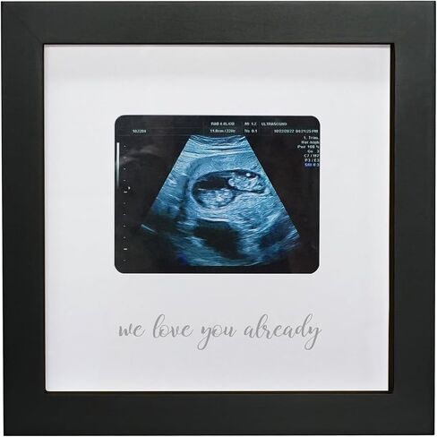 HAMUIERS Sonogram Signature Frame كتاب الضيوف، إطار تذكار للصور بالموجات فوق الصوتية، بدائل كتاب ضيوف استحمام الطفل، ديكور حفلات استحمام الطفل محايد جنسانيًا، هدية للأمهات المتوقعات، أبيض in Kuwait