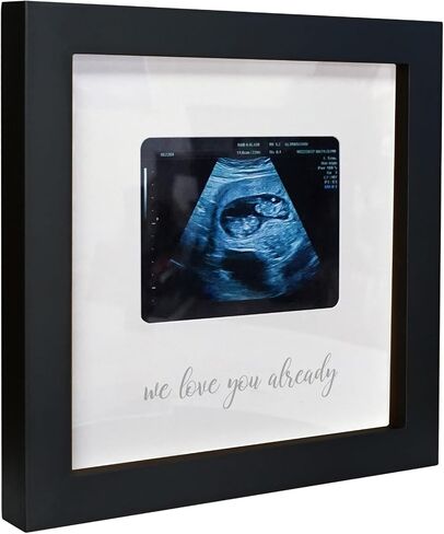 HAMUIERS Sonogram Signature Frame كتاب الضيوف، إطار تذكار للصور بالموجات فوق الصوتية، بدائل كتاب ضيوف استحمام الطفل، ديكور حفلات استحمام الطفل محايد جنسانيًا، هدية للأمهات المتوقعات، أبيض in Kuwait