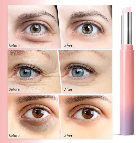 عصا العين، بلسم كريم الريتينول للعين للهالات السوداء والانتفاخات، علاج تحت العين للنساء والرجال، يقلل من الخطوط الدقيقة وأكياس العين والتجاعيد in Kuwait