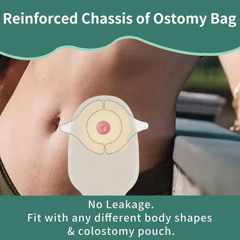 ZnnaYoha Skin Barrier Strips, Adhesive Barrier Extender Strips 20 Pcs, Y- Shaped Barrier Strips for All Colostomy Bags, Ostomy Supplies in Kuwait