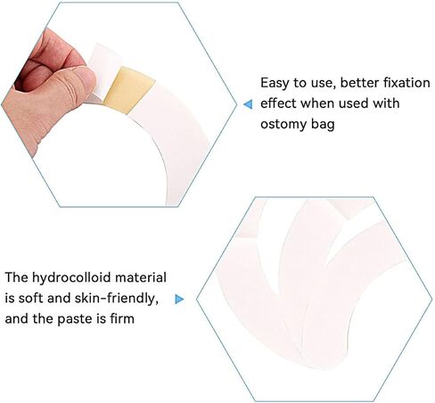 شرائط حاجز غرواني هيدروكولويد من ستياوسي، مطاط مقاوم للماء، لوازم الفطور لختم رائحة كيس ستوما الفطري - علبة من 20 قطعة in Kuwait