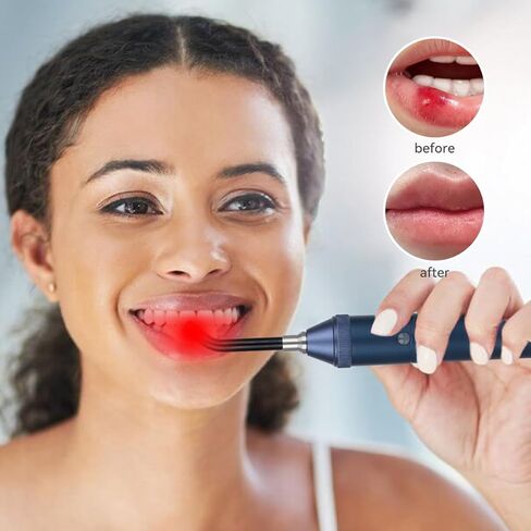 Red Light Therapy Cold Sores Treatment Healing Pain Relief for Lips Mouth Nose Ear,Knee Feet Hands Joint Muscle Nerve Health Care in Kuwait