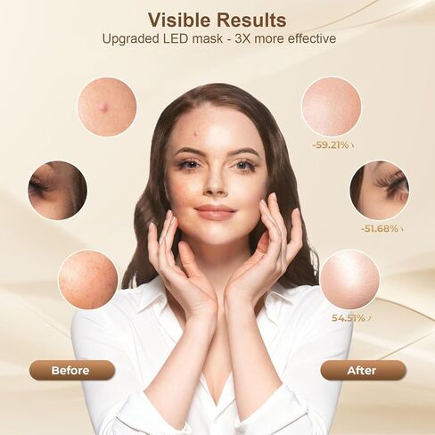 العلاج بالضوء الأحمر للوجه، اهتزاز للرقبة، الوجه أبيض in Kuwait