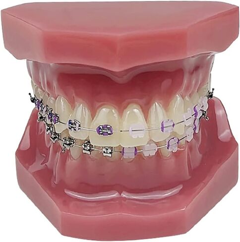 YOUYA DENTAL TM-208 Demonstration Orthodontic Model Teeth Teach Study Tools with Metal and Ceramic Bracket(Red) in Kuwait