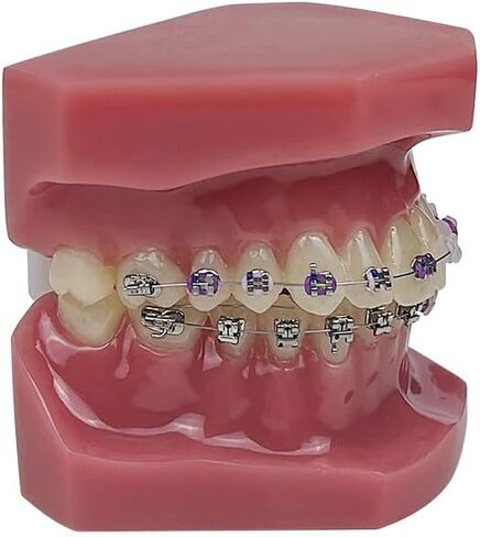 YOUYA DENTAL TM-208 Demonstration Orthodontic Model Teeth Teach Study Tools with Metal and Ceramic Bracket(Red) in Kuwait