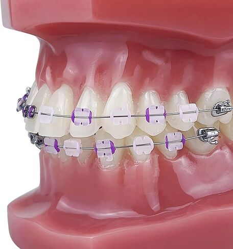 YOUYA DENTAL TM-208 Demonstration Orthodontic Model Teeth Teach Study Tools with Metal and Ceramic Bracket(Red) in Kuwait