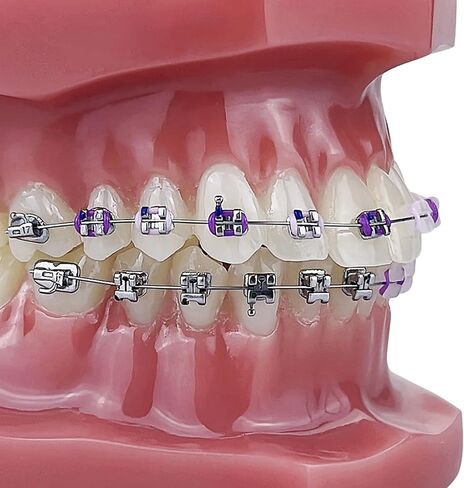 YOUYA DENTAL TM-208 Demonstration Orthodontic Model Teeth Teach Study Tools with Metal and Ceramic Bracket(Red) in Kuwait