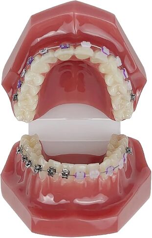 YOUYA DENTAL TM-208 Demonstration Orthodontic Model Teeth Teach Study Tools with Metal and Ceramic Bracket(Red) in Kuwait