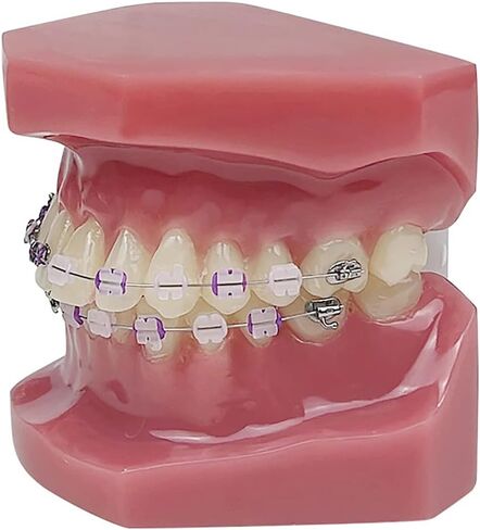 YOUYA DENTAL TM-208 Demonstration Orthodontic Model Teeth Teach Study Tools with Metal and Ceramic Bracket(Red) in Kuwait