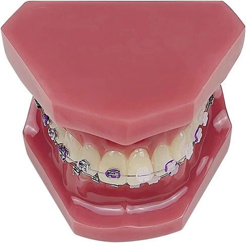 YOUYA DENTAL TM-208 Demonstration Orthodontic Model Teeth Teach Study Tools with Metal and Ceramic Bracket(Red) in Kuwait