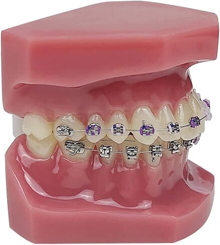 YOUYA DENTAL TM-208 Demonstration Orthodontic Model Teeth Teach Study Tools with Metal and Ceramic Bracket(Red) in Kuwait
