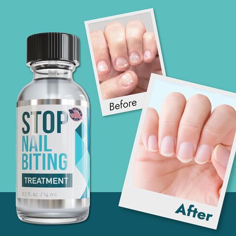 STOP NAIL BITING Treatment - Nail Polish To Help Stop Biting Nails, Bitter Taste, Easy To Apply, Safe For Children (0.5 Fluid Ounces) in Saudi Arabia