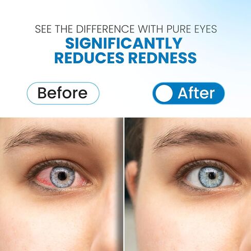 | Red Eyes Drops Redness Relief | Lubricating Eye Drops for Dry Eyes | Irritated Eyes Relief | Moisturizing Eye Drops | Travel Size 0.24 fl oz (7ml) | Pack of 3 | Made in USA in Saudi Arabia
