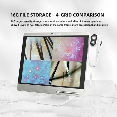 15.5 Inch Scalp Microscope, Skin Analysis Machine, with 16G Large Memory, Large HD Digital Display, 0X / 200X Dual Probes, for Hair Salon, SPA Beauty Shop in Saudi Arabia