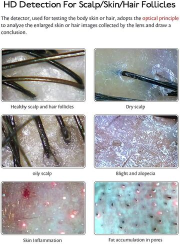 15.5 Inch Scalp Microscope, Skin Analysis Machine, with 16G Large Memory, Large HD Digital Display, 0X / 200X Dual Probes, for Hair Salon, SPA Beauty Shop in Saudi Arabia