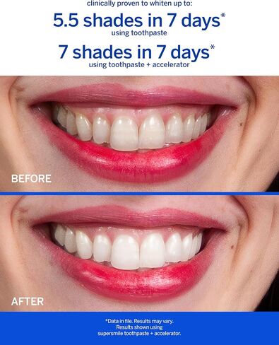 Supersmile Professional Teeth Whitening Toothpaste - Fluoride Free 4.2 Oz in Saudi Arabia
