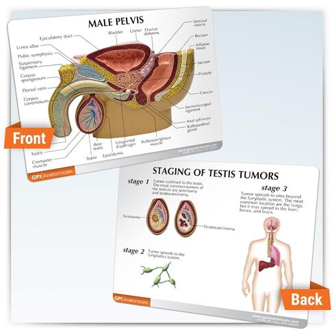 GPI التشريحية - نموذج التشريح البشري للحوض الذكور مع تضخم البروستاتا الحميد (BPH) ، نسخة طبق الأصل من أجل علم التشريح ، تعليم علم وظائف الأعضاء ، نموذج التشريح لمكتب الطبيب ، موارد التعلم الطبي in Kuwait