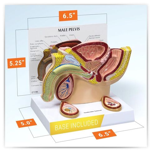 GPI التشريحية - نموذج التشريح البشري للحوض الذكور مع تضخم البروستاتا الحميد (BPH) ، نسخة طبق الأصل من أجل علم التشريح ، تعليم علم وظائف الأعضاء ، نموذج التشريح لمكتب الطبيب ، موارد التعلم الطبي in Kuwait